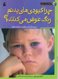 چرا کبودی های بدنم رنگ عوض می کنند