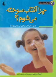 چرا آفتاب سوخته می شوم